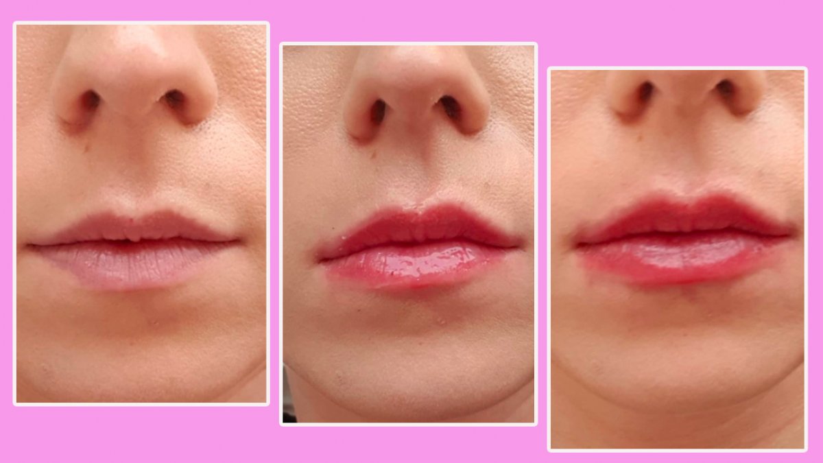Wij Hebben M Voor Je Getest Smeersel Met Het Effect Van Lipfillers C